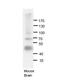 Double-stranded RNA-specific editase 1 antibody, 29-266, ProSci, Enzyme Linked Immunosorbent Assay image 