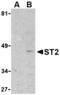 Interleukin 1 Receptor Like 1 antibody, AHP999, Bio-Rad (formerly AbD Serotec) , Western Blot image 