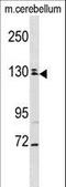 TBC1 Domain Family Member 8 antibody, LS-C161735, Lifespan Biosciences, Western Blot image 