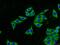 M6PR antibody, 20253-1-AP, Proteintech Group, Immunofluorescence image 