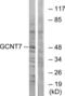 Glucosaminyl (N-Acetyl) Transferase Family Member 7 antibody, LS-C119777, Lifespan Biosciences, Western Blot image 