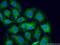 Dihydropyrimidinase Like 5 antibody, 10525-1-AP, Proteintech Group, Immunofluorescence image 