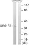 Olfactory Receptor Family 51 Subfamily F Member 2 antibody, GTX87289, GeneTex, Western Blot image 