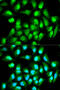 RAN, Member RAS Oncogene Family antibody, 13-347, ProSci, Immunofluorescence image 