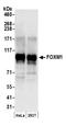 Forkhead Box M1 antibody, A301-533A, Bethyl Labs, Western Blot image 