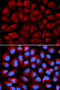 Fanconi anemia group C protein antibody, STJ23623, St John