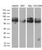 Calcium Voltage-Gated Channel Auxiliary Subunit Beta 1 antibody, M05080, Boster Biological Technology, Western Blot image 