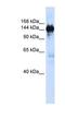 Phosphoribosylformylglycinamidine Synthase antibody, NBP1-70692, Novus Biologicals, Western Blot image 