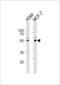 Protein Phosphatase 2 Regulatory Subunit Bgamma antibody, PA5-49389, Invitrogen Antibodies, Western Blot image 