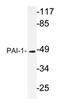 Plasminogen activator inhibitor 1 antibody, AP20625PU-N, Origene, Western Blot image 