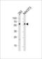 Bone Morphogenetic Protein Receptor Type 1A antibody, 60-842, ProSci, Western Blot image 