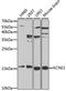Potassium voltage-gated channel subfamily E member 1 antibody, A1176, ABclonal Technology, Western Blot image 