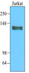 CD45 antibody, AM09001PU-S, Origene, Western Blot image 