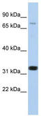 Voltage-dependent L-type calcium channel subunit beta-2 antibody, TA341726, Origene, Western Blot image 