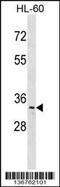 TP53 Regulating Kinase antibody, 58-875, ProSci, Western Blot image 