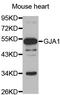 Gap Junction Protein Alpha 1 antibody, A2163, ABclonal Technology, Western Blot image 