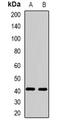F-Box Protein 32 antibody, orb340869, Biorbyt, Western Blot image 