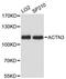 Actinin Alpha 3 (Gene/Pseudogene) antibody, A12797, ABclonal Technology, Western Blot image 