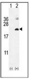 Interleukin-17F antibody, AP52188PU-N, Origene, Western Blot image 