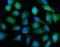ATPase H+ Transporting V1 Subunit A antibody, A10401-1, Boster Biological Technology, Immunofluorescence image 
