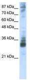 TRNA Methyltransferase 10A antibody, TA344004, Origene, Western Blot image 