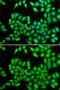 Minichromosome Maintenance Complex Component 3 antibody, GTX55699, GeneTex, Immunocytochemistry image 