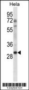 Non-Homologous End Joining Factor 1 antibody, 57-772, ProSci, Western Blot image 