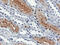 Sedoheptulokinase antibody, M09991-1, Boster Biological Technology, Immunohistochemistry paraffin image 