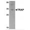 Acid Phosphatase 5, Tartrate Resistant antibody, MBS150519, MyBioSource, Western Blot image 
