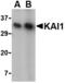 ST6 antibody, AHP1709, Bio-Rad (formerly AbD Serotec) , Immunohistochemistry paraffin image 