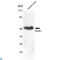 SMAD Family Member 5 antibody, LS-C813119, Lifespan Biosciences, Western Blot image 