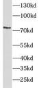 TNF Receptor Superfamily Member 1B antibody, FNab08824, FineTest, Western Blot image 