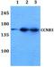 Cyclin B3 antibody, A07572, Boster Biological Technology, Western Blot image 