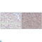 MLL antibody, LS-C814058, Lifespan Biosciences, Immunohistochemistry paraffin image 