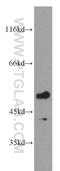 Ribosomal RNA-processing protein 8 antibody, 20129-1-AP, Proteintech Group, Western Blot image 