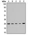 Phosphomannomutase 2 antibody, LS-C667964, Lifespan Biosciences, Western Blot image 