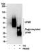 Plasminogen Activator, Urokinase Receptor antibody, A304-462A, Bethyl Labs, Western Blot image 