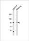 Leucine Rich Repeat Containing 8 VRAC Subunit A antibody, PA5-49209, Invitrogen Antibodies, Western Blot image 