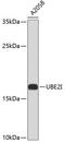 Ubiquitin Conjugating Enzyme E2 I antibody, 13-034, ProSci, Western Blot image 
