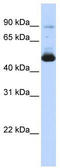 Keratin 16 antibody, TA346410, Origene, Western Blot image 