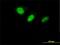 DnaJ homolog subfamily C member 7 antibody, H00007266-M01, Novus Biologicals, Immunocytochemistry image 