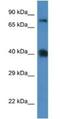 Cationic amino acid transporter 3 antibody, NBP1-74144, Novus Biologicals, Western Blot image 