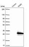 Nucleoside diphosphate kinase homolog 5 antibody, PA5-60746, Invitrogen Antibodies, Western Blot image 