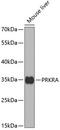 Protein Activator Of Interferon Induced Protein Kinase EIF2AK2 antibody, 19-650, ProSci, Western Blot image 