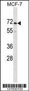 PRAME Family Member 2 antibody, 58-418, ProSci, Western Blot image 