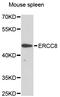 ERCC Excision Repair 8, CSA Ubiquitin Ligase Complex Subunit antibody, abx126900, Abbexa, Western Blot image 