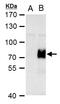 AT-Rich Interaction Domain 5A antibody, GTX122605, GeneTex, Western Blot image 