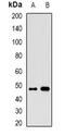 ALG2 Alpha-1,3/1,6-Mannosyltransferase antibody, orb341370, Biorbyt, Western Blot image 