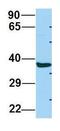 Abhydrolase Domain Containing 17A antibody, GTX16552, GeneTex, Western Blot image 