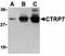 C1q And TNF Related 7 antibody, orb74684, Biorbyt, Western Blot image 